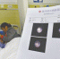 强强住进四川结石病医院，输尿管镜检查报告单显示：临床诊断为膀胱结石 - 新浪吉林